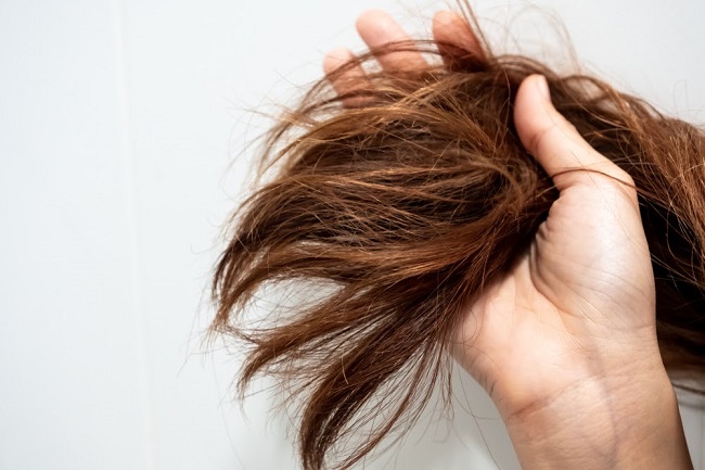 Common Causes of Hair Loss in Women
